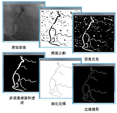 機(jī)器視覺-應(yīng)用實例